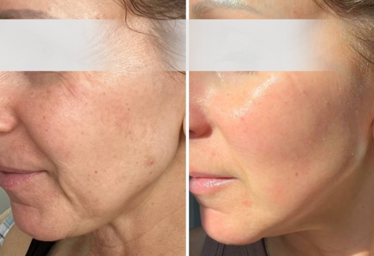 Galleria Foto & Video