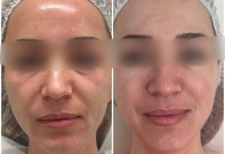 Galleria Foto & Video